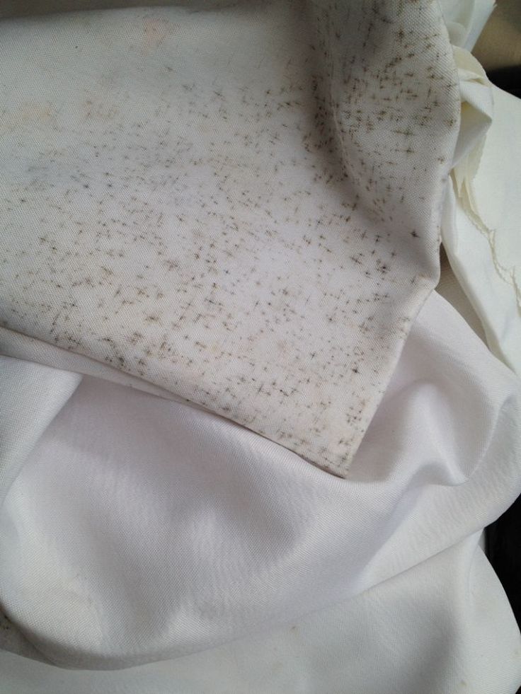 Clothes with mildew spots